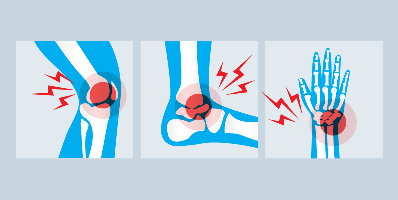 Images of an injured knee, ankle, and wrist